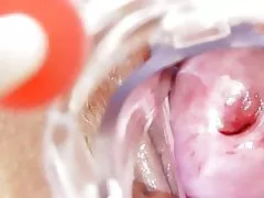 Prljava sestra dobiva solo